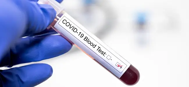 Test coronavirus